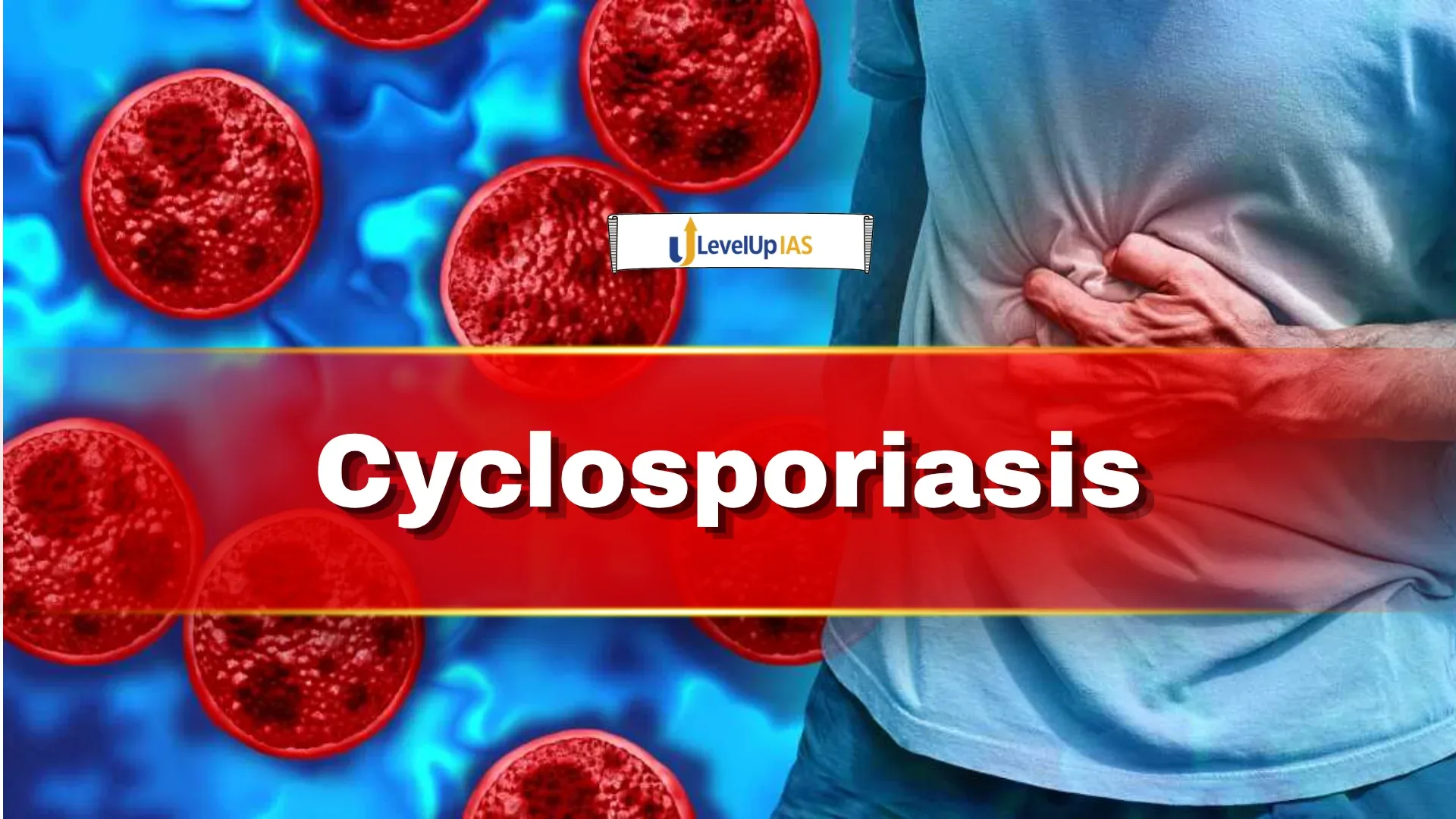 Cyclosporiasis